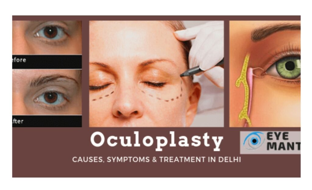 oculoplasty