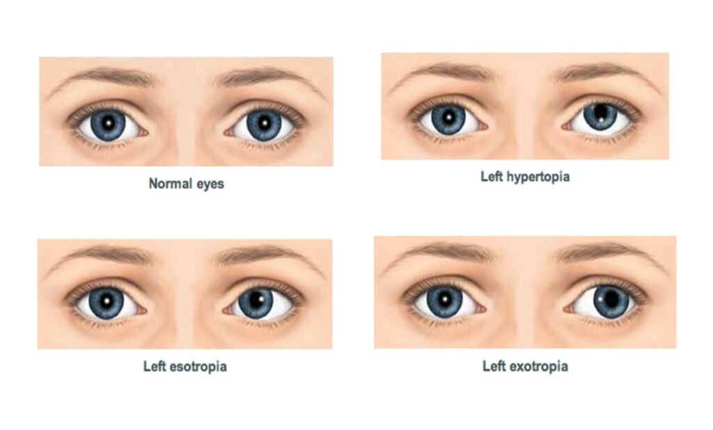 eyes
