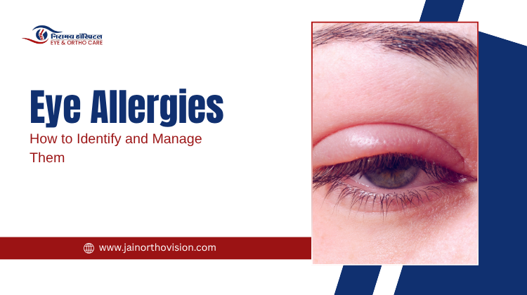 Eye Allergies: How to Identify and Manage Them