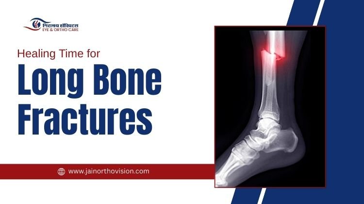 Healing Time for Long Bone Fractures