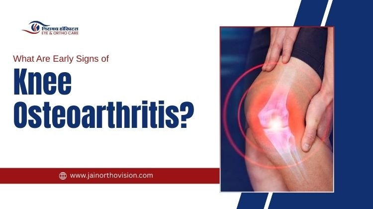 What Are the Early Signs of Knee Osteoarthritis?