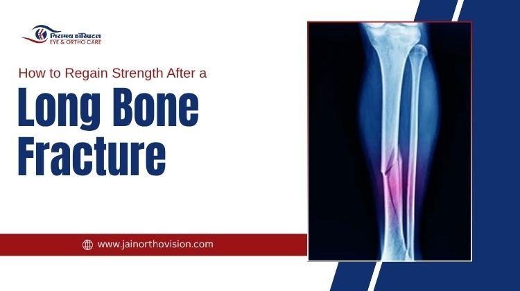Rehabilitation and exercises to regain strength after a long bone fracture for faster recovery and improved mobility