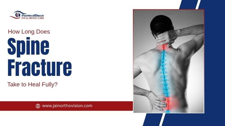 How Long Does Spine Fracture Take to Heal Fully?