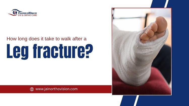 How long does it take to walk after a leg fracture?