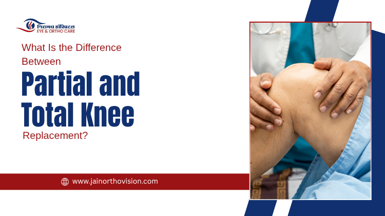 Difference Between Partial and Total Knee Replacement